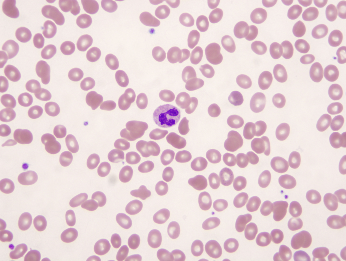 Peripheral blood